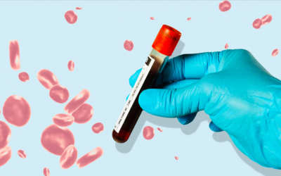 What to Know About Galleri, the New Blood Test Said to Detect More Than 50 Different Types of Cancer